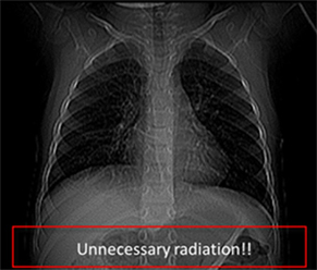 Radiation safety cases